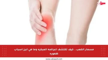 مسمار الكعب.. كيف تكتشف أعراضه المبكرة وما هي أبرز أسباب ظهوره